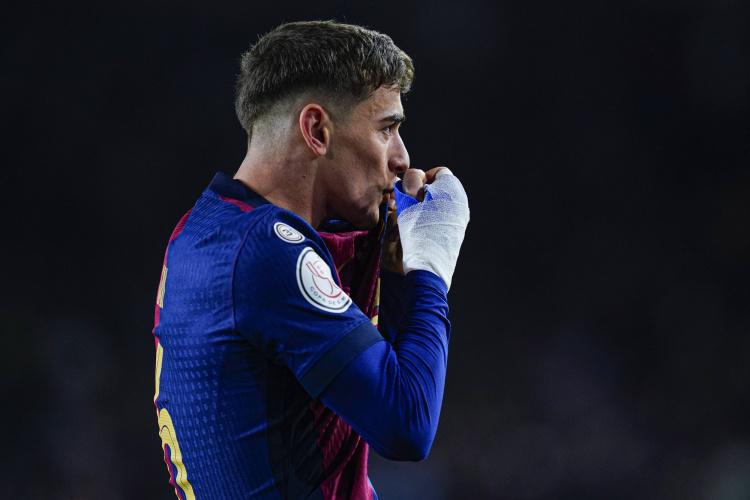 诺的比赛及, 其竞争意识, net